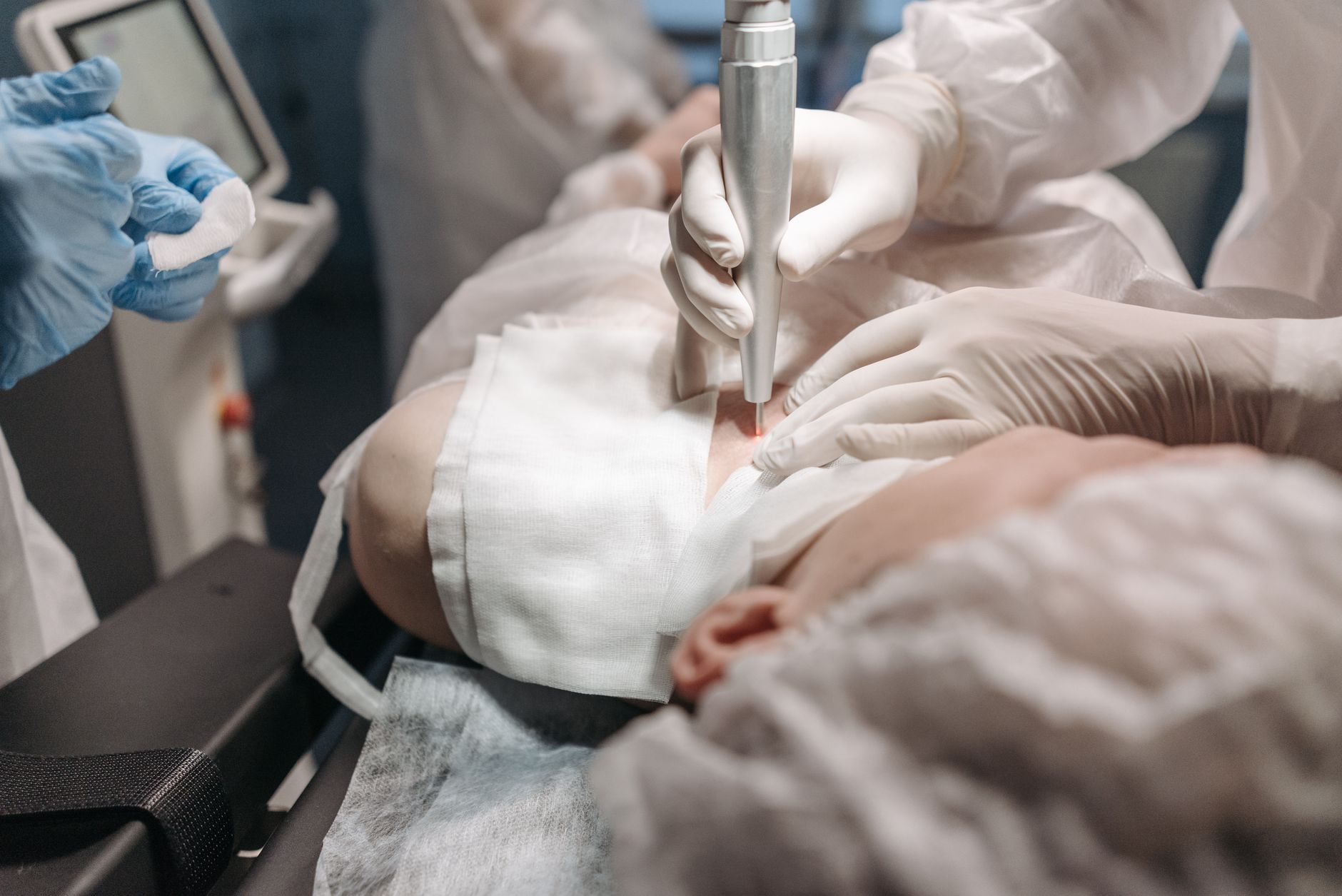 Medical professionals performing laser skin treatment in a clinical setting.